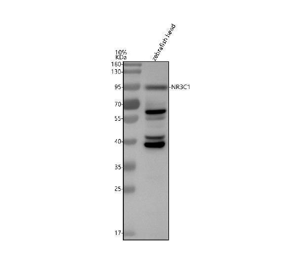  Western blot analysis of Glucocorticoid receptor/NR3C1 using anti-Glucocorticoid receptor/NR3C1 antibody (AZQ1XHK0)