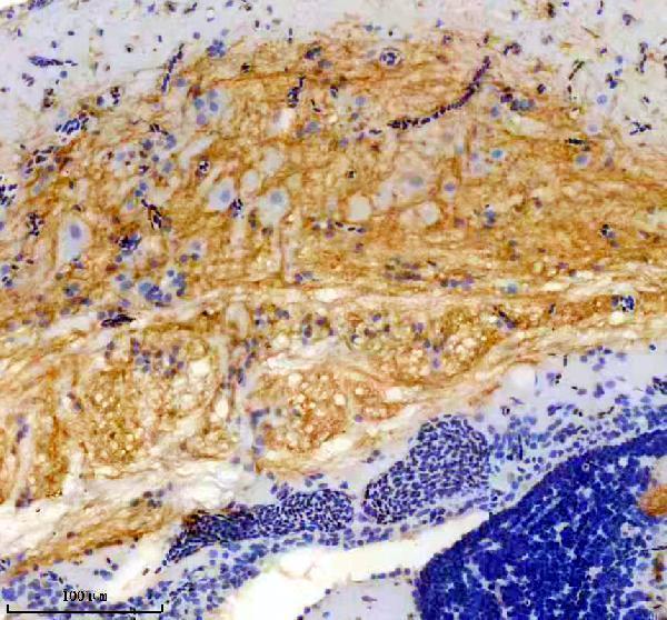 azq285p3 slc2a1a primary antibodies ihc testing 1