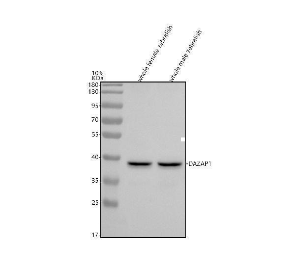  Western blot analysis of DAZAP1 using anti-DAZAP1 antibody (AZQ29R83)