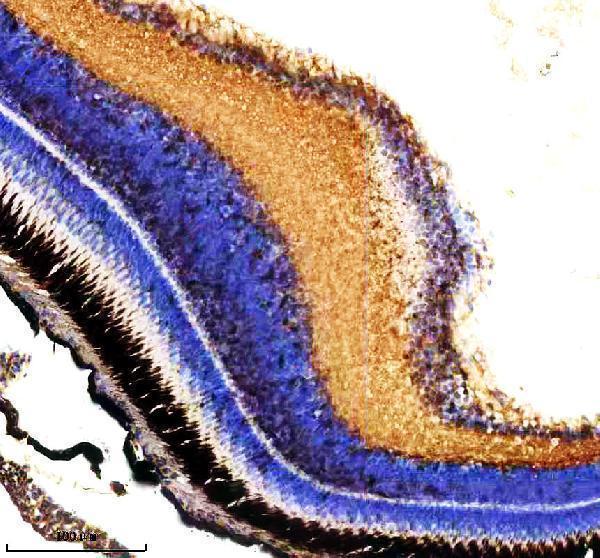azq32lt1 cyp3a65 primary antibodies ihc testing 2
