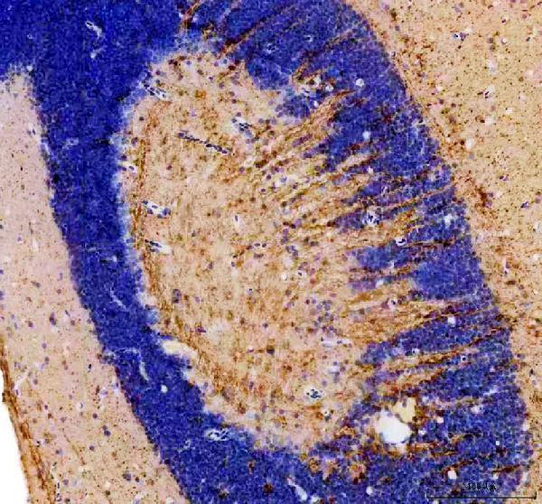azq32lt1 cyp3a65 primary antibodies ihc testing 3