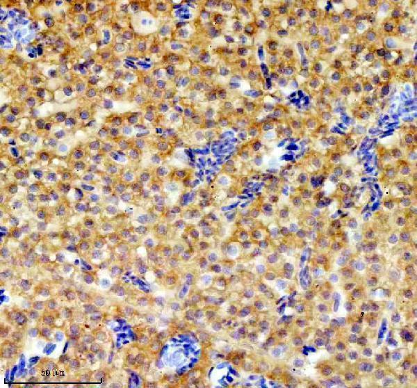  IHC analysis of GRPEL1 using anti-GRPEL1 antibody (AZQ32PS5)