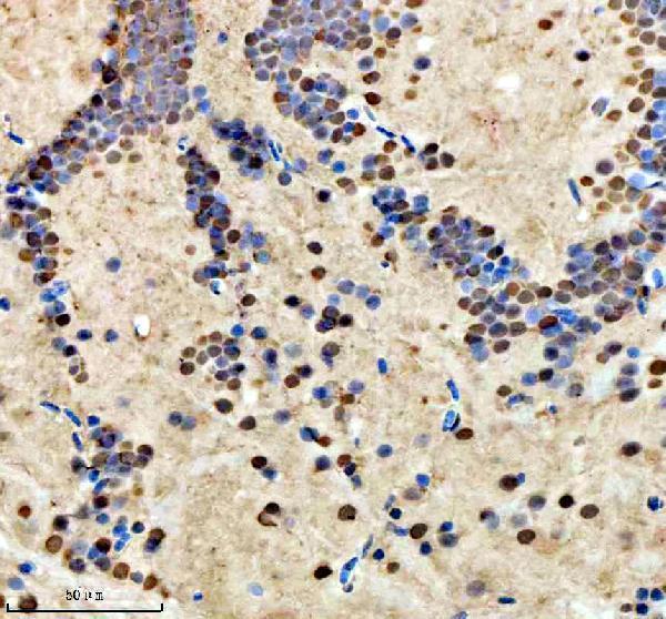 azq32pt3 hmgb2a b primary antibodies ihc testing 2