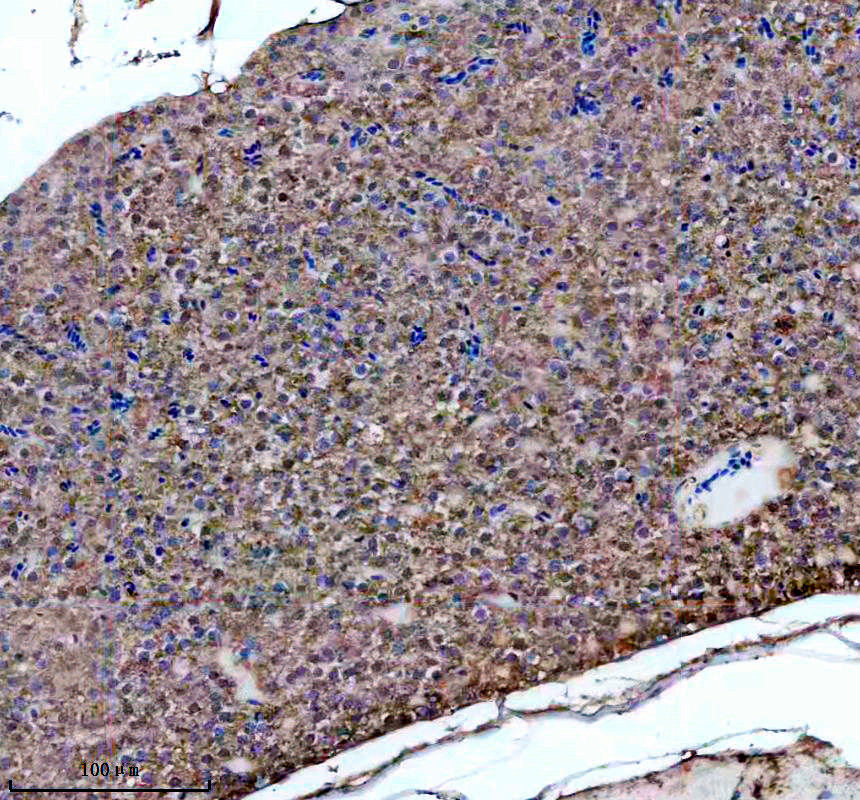 azq3b7r0 cyc1 primary antibodies ihc testing 1