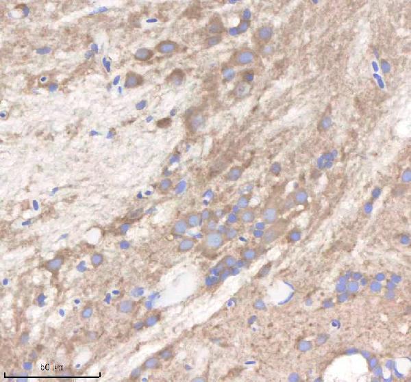azq49gp3 pi4kb primary antibodies ihc testing 1