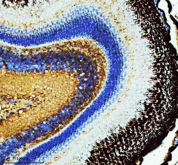 azq567y8 ppp2ca primary antibodies ihc testing 2