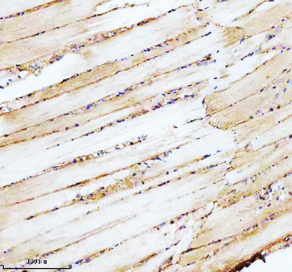 azq567y8 ppp2ca primary antibodies ihc testing 3
