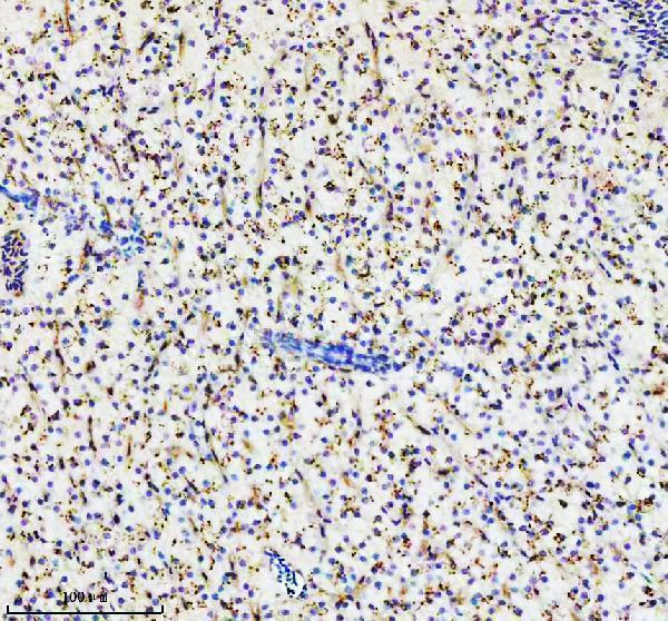 azq567y8 ppp2ca primary antibodies ihc testing 4