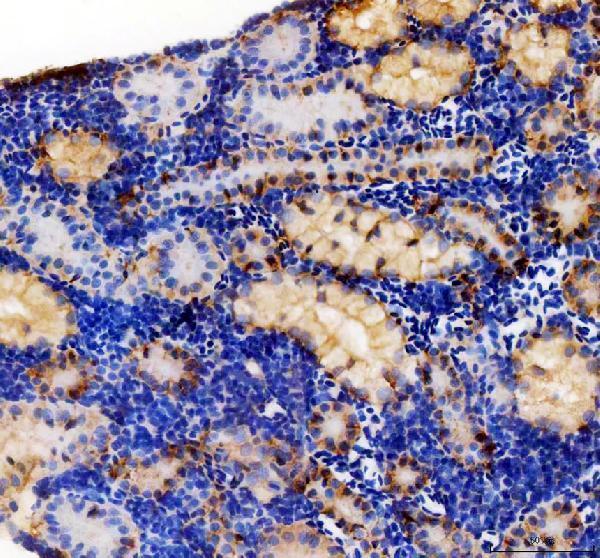 IHC analysis of EPCAM using anti-EPCAM antibody (AZQ568H0)