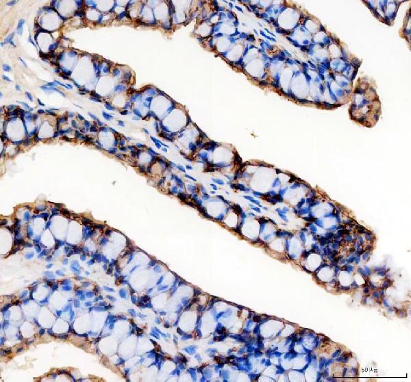 IHC analysis of EPCAM using anti-EPCAM antibody (AZQ568H0)