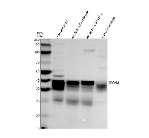 Western blot analysis of EPCAM using anti-EPCAM antibody (AZQ568H0)