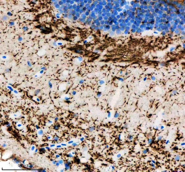 azq568k0 hrasa b primary antibodies ihc testing 2
