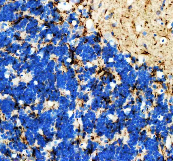 azq568k0 hrasa b primary antibodies ihc testing 3