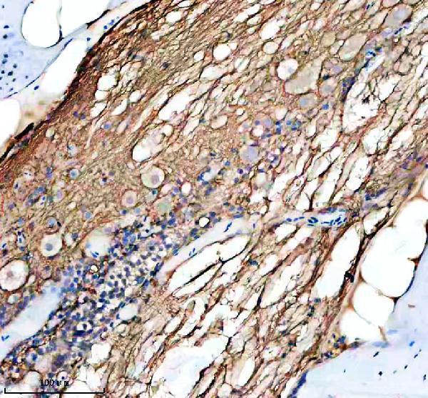 azq568k0 hrasa b primary antibodies ihc testing 4