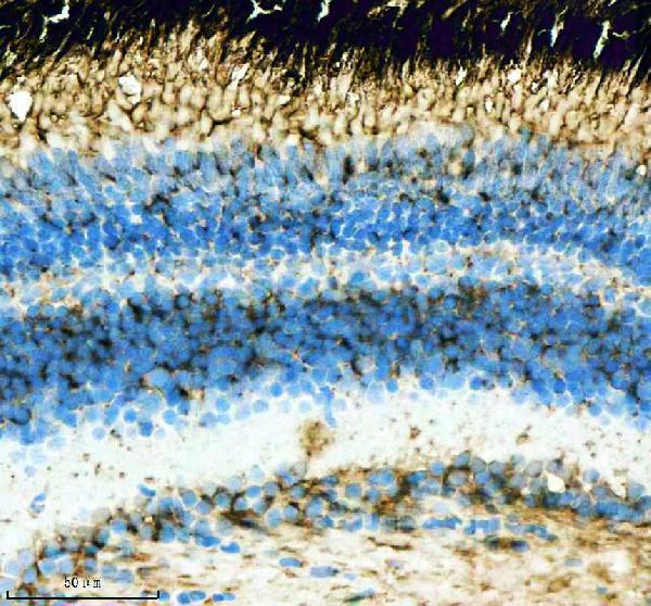 azq568k0 hrasa b primary antibodies ihc testing 5