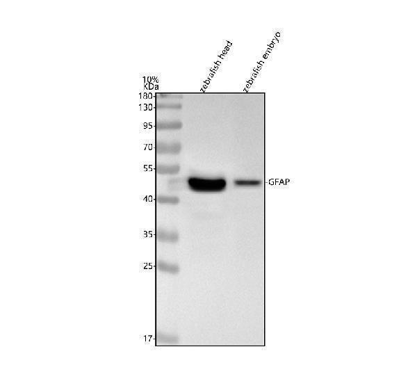  Western blot analysis of GFAP using anti-GFAP antibody (AZQ58EE9)