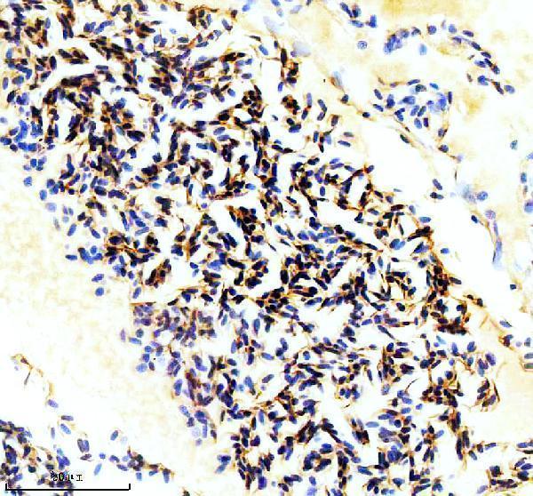 azq5blf6 hbbe3 primary antibodies ihc testing 1