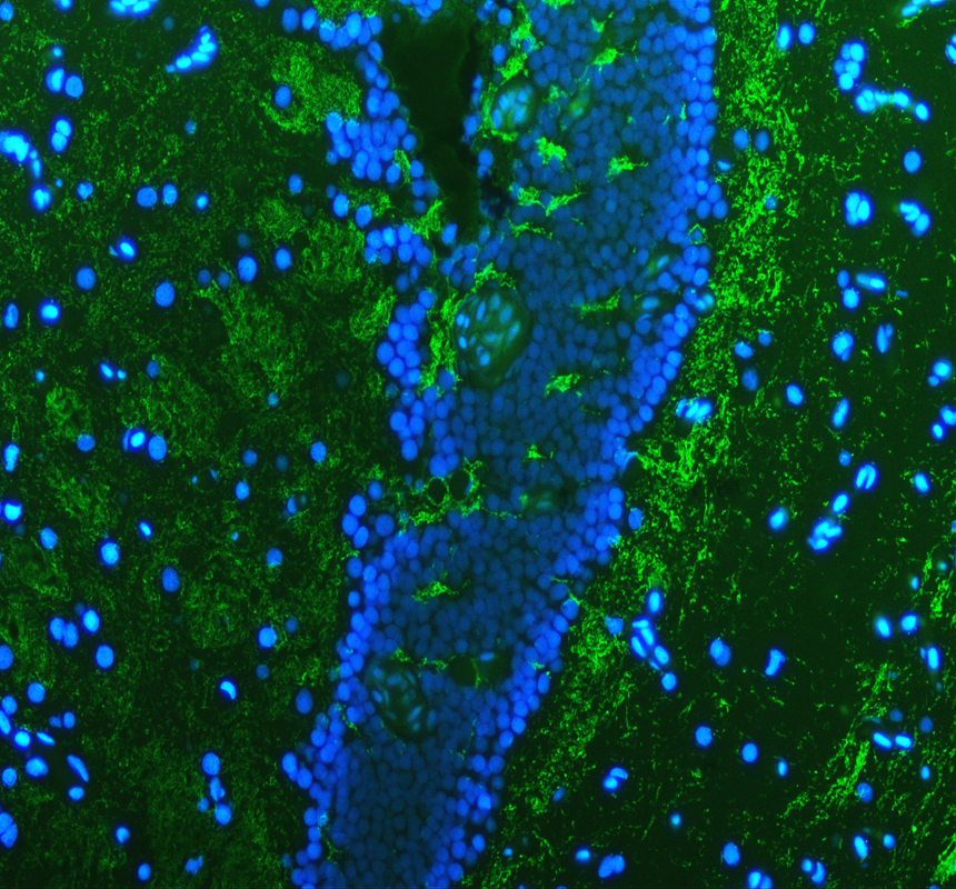 IF analysis of MBPA using anti-MBPA antibody (AZQ5I2C7)