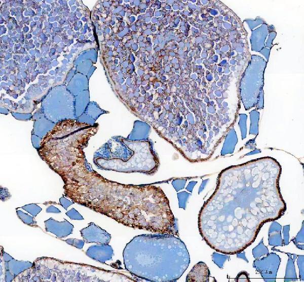 IHC analysis of GDF9 using anti-GDF9 antibody (AZQ5MD90)