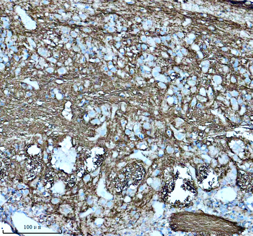 azq5rgg3 hgfa primary antibodies ihc testing 1