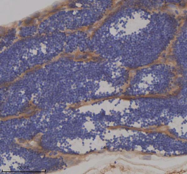  IHC analysis of IFT172 using anti-IFT172 antibody (AZQ5RHH4)