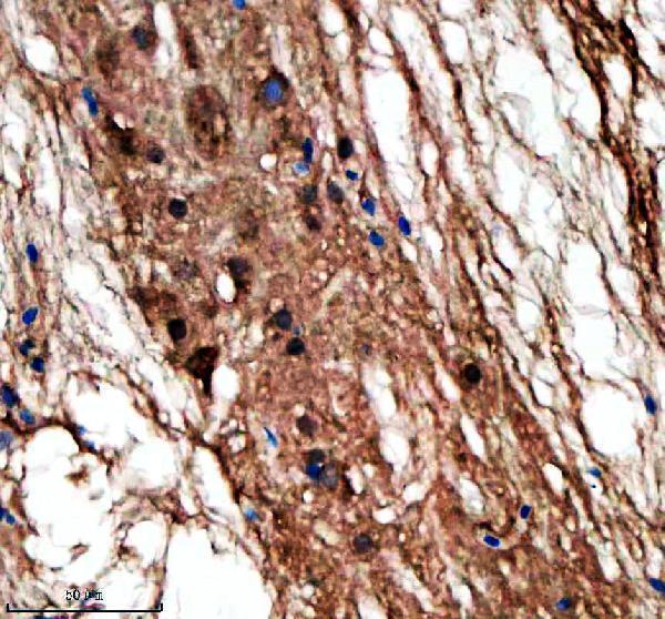  IHC analysis of LIN9 using anti-LIN9 antibody (AZQ5RHQ8)