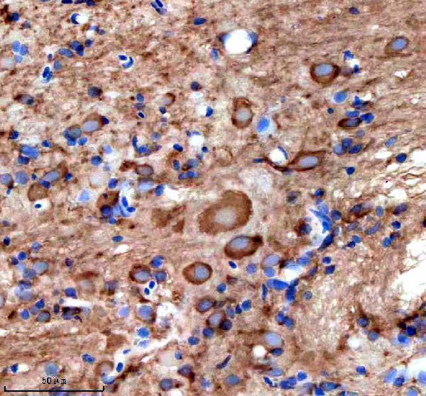 IHC analysis of STIP1 using anti-STIP1 antibody (AZQ5RKM3)