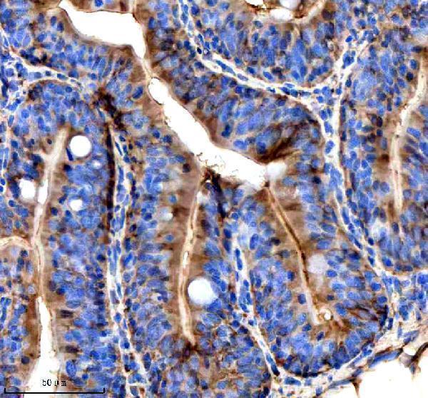 IHC analysis of STIP1 using anti-STIP1 antibody (AZQ5RKM3)
