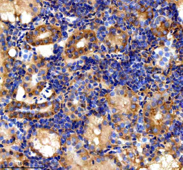 azq5rkm3 stip1 primary antibodies ihc testing 3