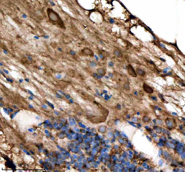 azq5rkm3 stip1 primary antibodies ihc testing 4
