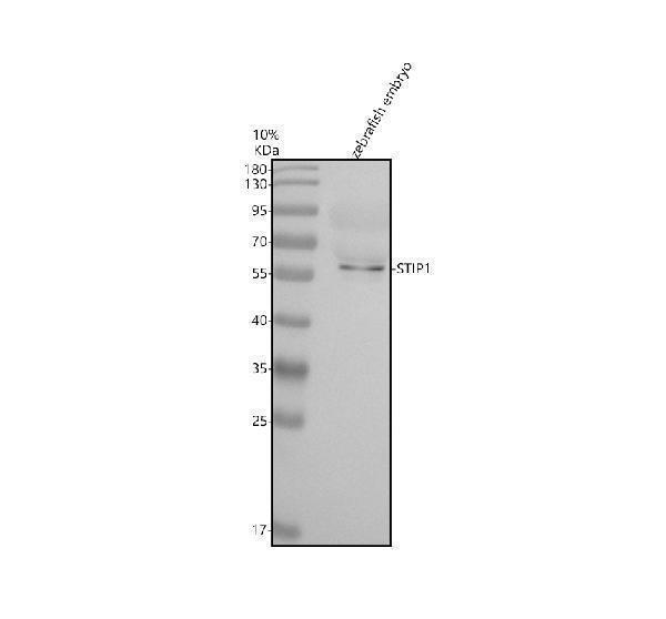 Western blot analysis of STIP1 using anti-STIP1 antibody (AZQ5RKM3)