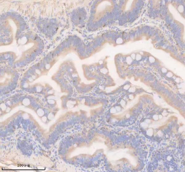 azq5tle6 ifng1r primary antibodies ihc testing 1