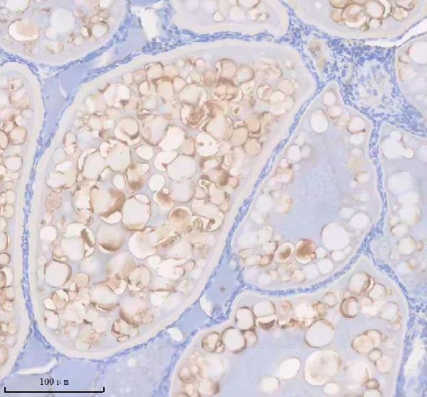 azq5tle6 ifng1r primary antibodies ihc testing 2