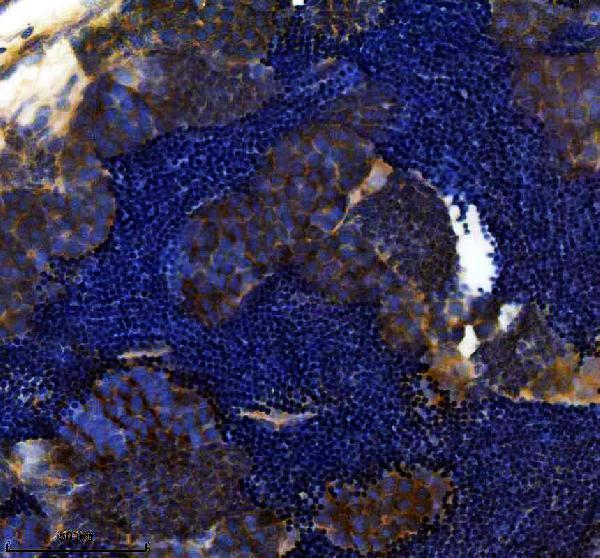 IHC analysis of RAD51 using anti-RAD51 antibody (AZQ5TYR1)