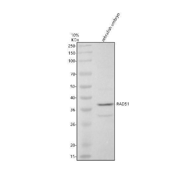 Western blot analysis of RAD51 using anti-RAD51 antibody (AZQ5TYR1)