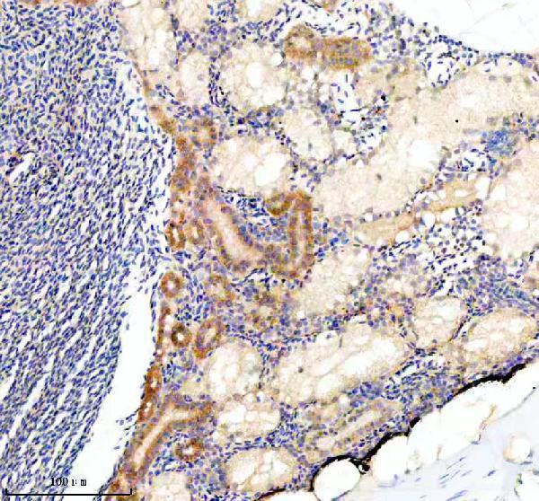  IHC analysis of COPE using anti-COPE antibody (AZQ5U3E8)