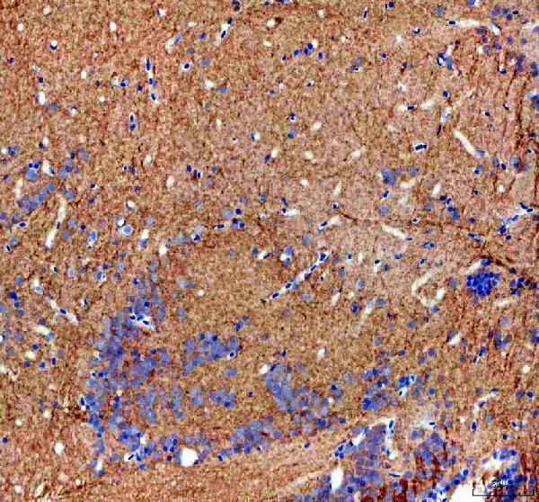  IHC analysis of COPE using anti-COPE antibody (AZQ5U3E8)