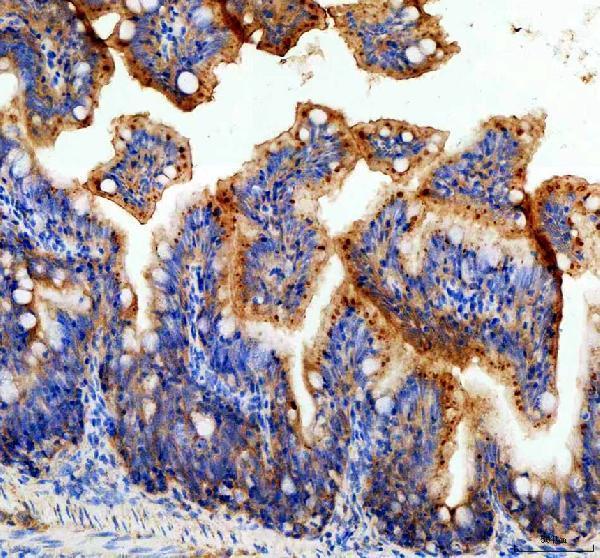  IHC analysis of COPE using anti-COPE antibody (AZQ5U3E8)