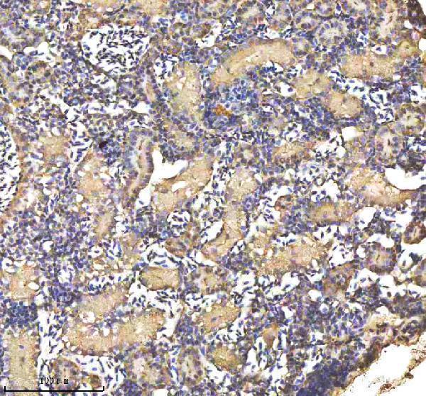 azq5u870 cyp19a1b primary antibodies ihc testing 3