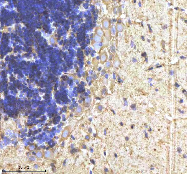 azq5u870 cyp19a1b primary antibodies ihc testing 5