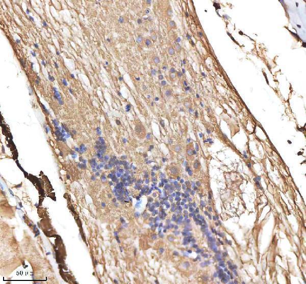 azq5u870 cyp19a1b primary antibodies ihc testing 6