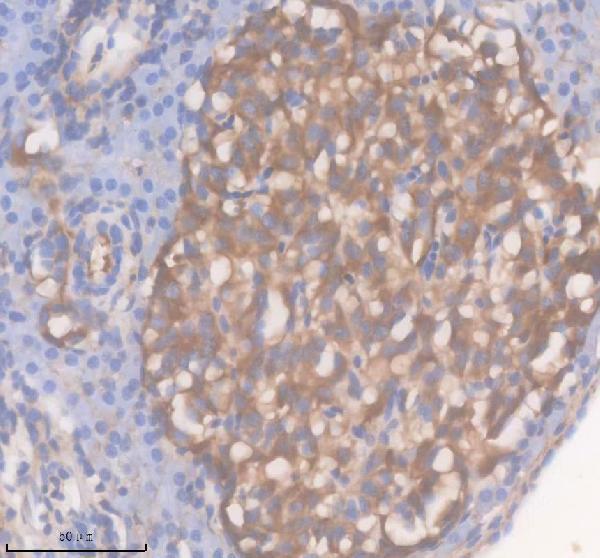 IHC analysis of ACOX1 using anti-ACOX1 antibody (AZQ5XIZ4)