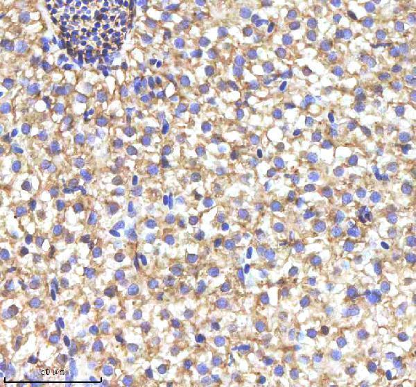  IHC analysis of MYD88 using anti-MYD88 antibody (AZQ5XJ85)