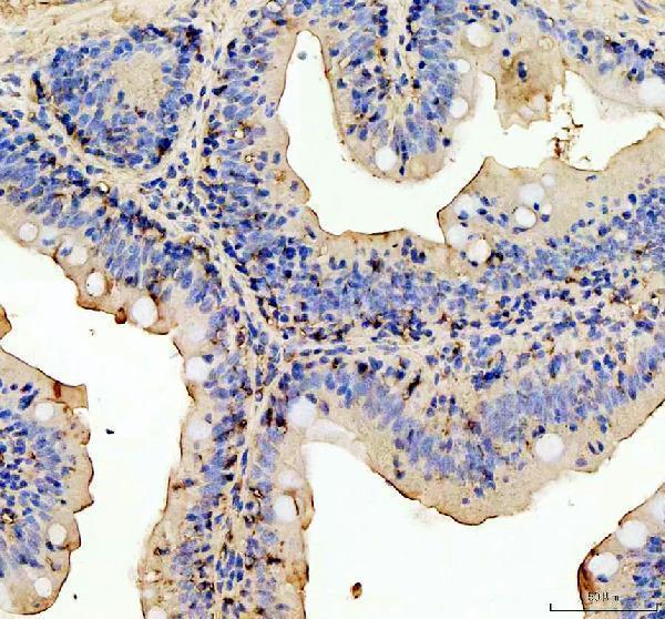 IHC analysis of MYD88 using anti-MYD88 antibody (AZQ5XJ85)