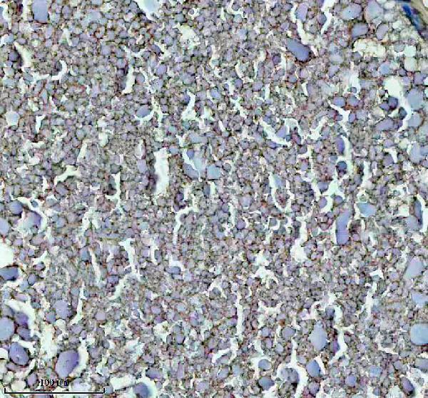 IHC analysis of GNRH2 using anti-GNRH2 antibody (AZQ5Y835)