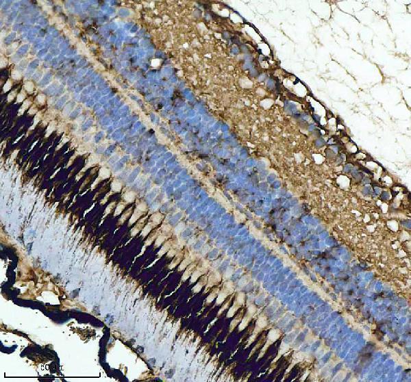 IHC analysis of GNRH2 using anti-GNRH2 antibody (AZQ5Y835)