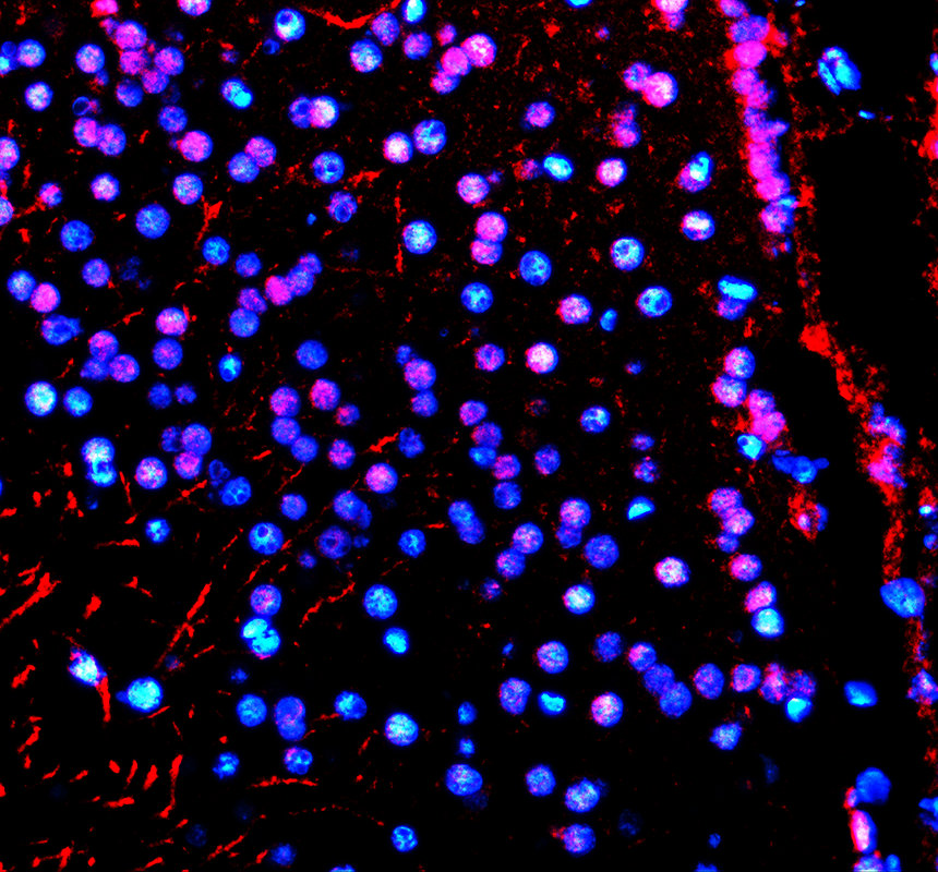 azq66hu5 hat1 primary antibodies if testing 1