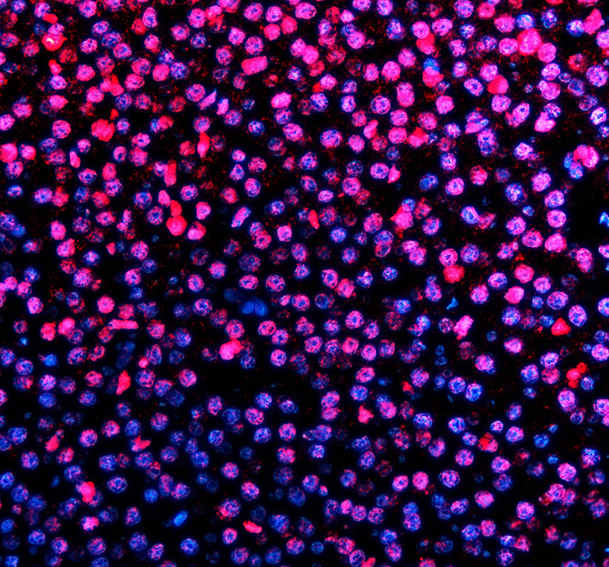 azq66hu5 hat1 primary antibodies if testing 2