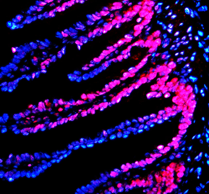 azq66hu5 hat1 primary antibodies if testing 3