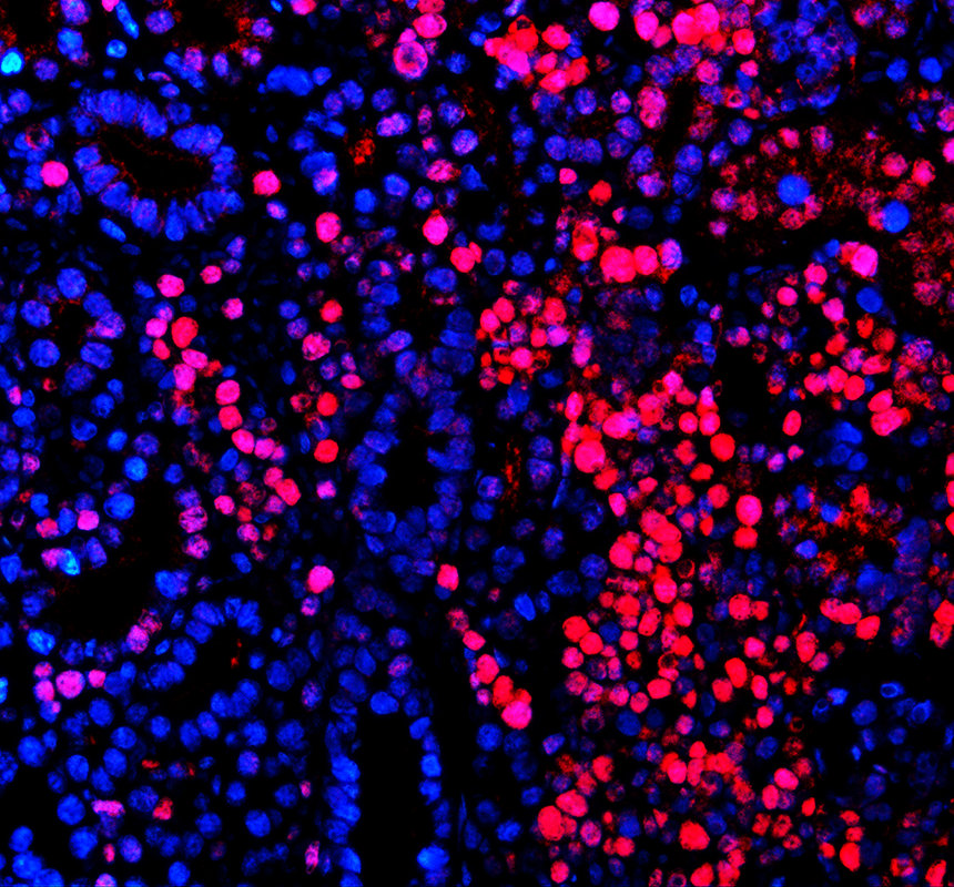 azq66hu5 hat1 primary antibodies if testing 4